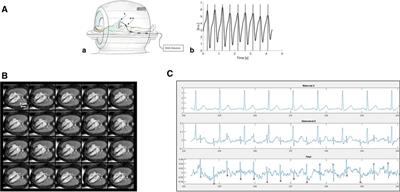 The current state and potential innovation of fetal cardiac MRI